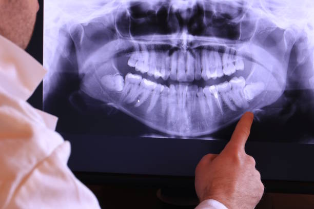 Best Emergency Gum Treatment in Hoopeston, IL