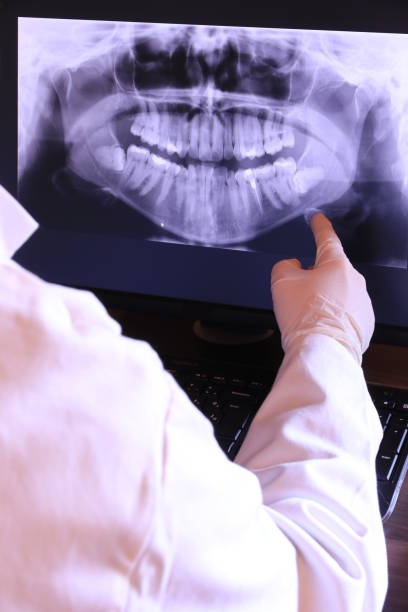 Best Emergency Dental Care for Broken or Chipped Teeth in Hoopeston, IL